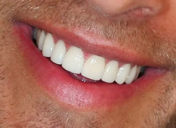 The Harley Street Smile Clinic - Cosmetic dentist in London