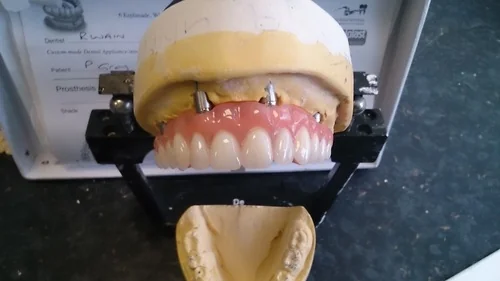 The Dental Studio Prosthetics - Dental clinic in Whitley Bay