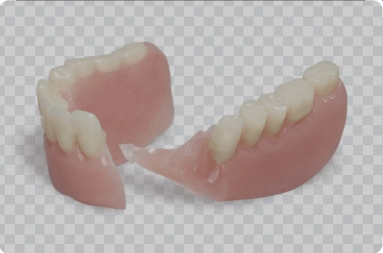 WGR Denture Repairs - Doncaster - Dental laboratory in Doncaster