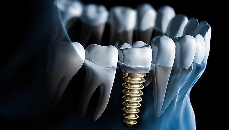 The Anchorage Dental Care & Implant Centre - Dentist in Southsea