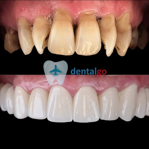 DentalGo Tourism - Dental clinic in London