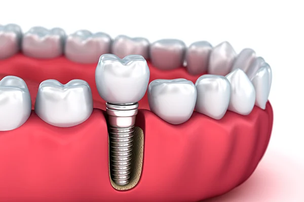 Stone Cottage Dental Surgery - Dental clinic in GB