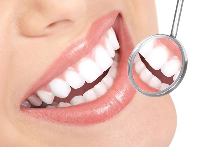 Newcastle Teeth Whitening - Dentist in Newcastle upon Tyne