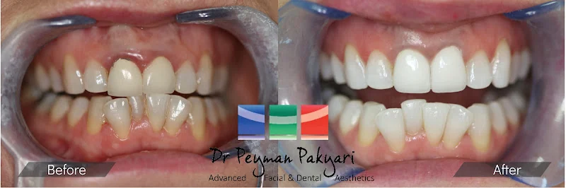 Dr Peyman Advanced Facial & Dental Aesthetics - Cosmetic dentist in Sevenoaks