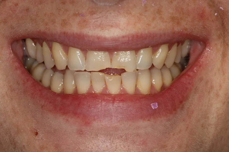 Coach House Dental Practice - Dentist in Camberley