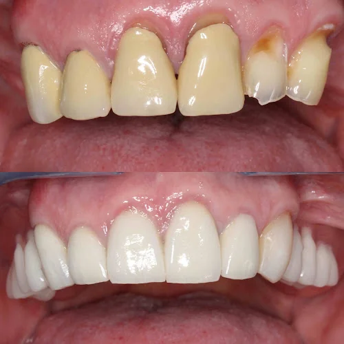 Thackeray Dental Care - Dentist in Mansfield