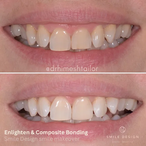 Smile Design Dental Practice - Dentist in Aylesbury