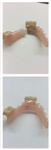 Denture Repair Express - Dental laboratory in UK