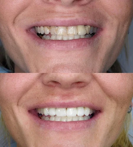 Dulwich Dental Office - Dentist in London