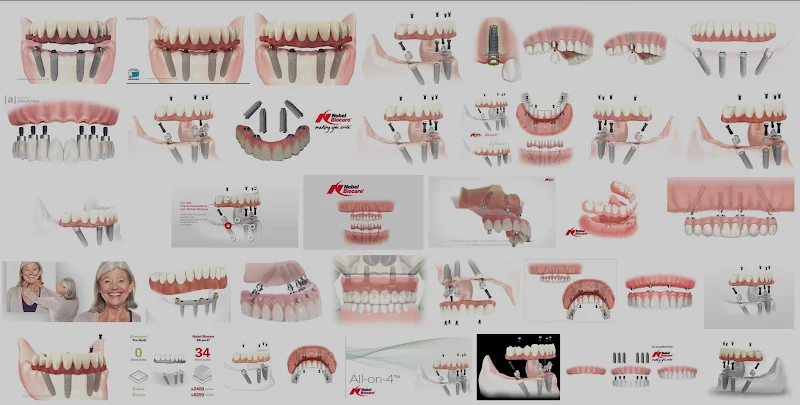 Cotswold Dental implants - Dental clinic in Cirencester