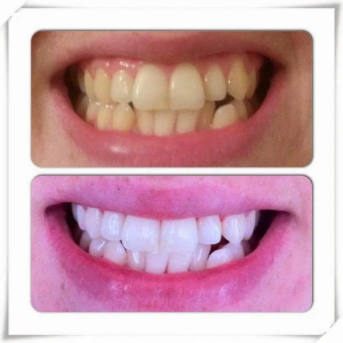 Stand Out Smile - Cosmetic dentist in UK