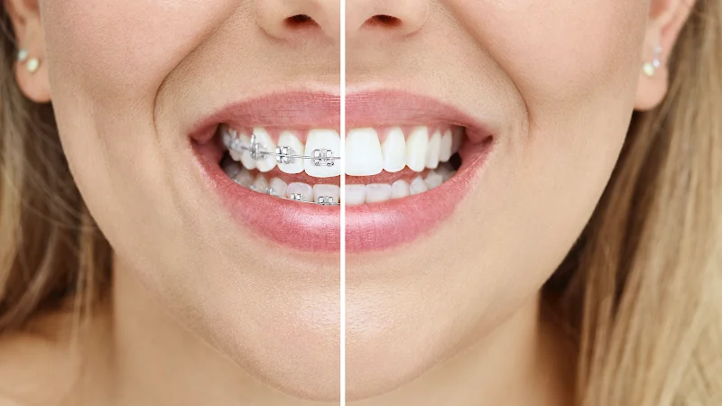 Crouch End Orthodontics - Orthodontist in London