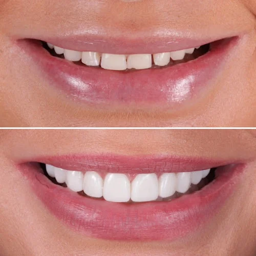 Bushey Heath Dental Centre - Dentist in Bushey