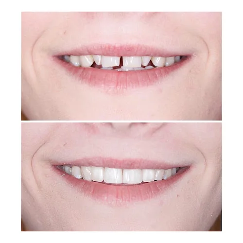 Doctor Dhillon Dental Clinic - Dentist in Stourbridge