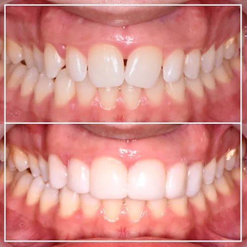 Sunna Dental - Cosmetic dentist in Birmingham