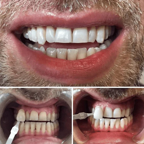 Adelphi Dental Care - Dental clinic in Preston