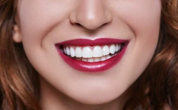 Alpha Veneers - Dentist in Staines