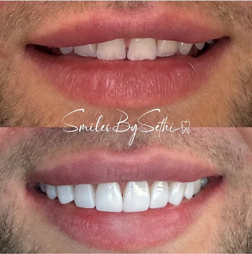 Berkeley Dental x SmilesBySethi - Dental clinic in Hounslow