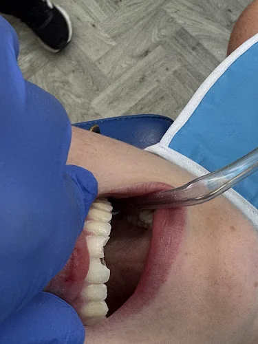 Emergency Dentist London 24/7 Open - Dentist in London