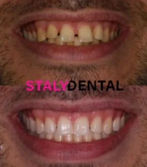 STALY Dental - Stalybridge - Dental clinic in Stalybridge