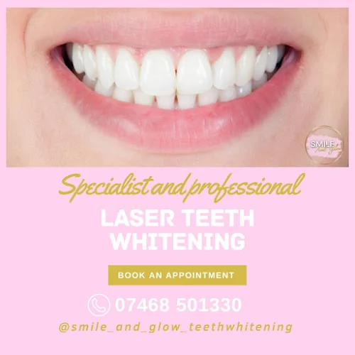 Smile and Glow - Teeth whitening service in Poole