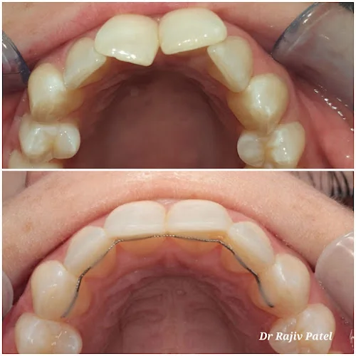 Inspire Dental Care: Implant & Invisalign Centre - Dentist in Rickmansworth