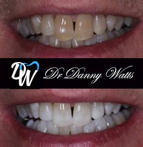 Dr Danny Watts - Dentist in UK