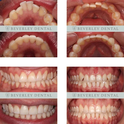 Beverley Dental - Dentist in London