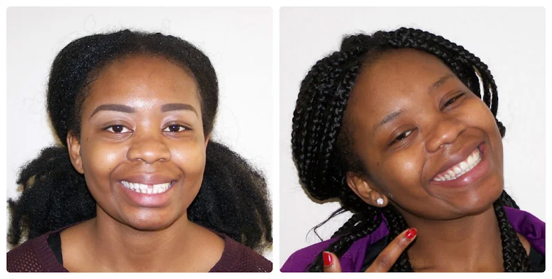 Straight White Teeth Ealing - Dental clinic in London