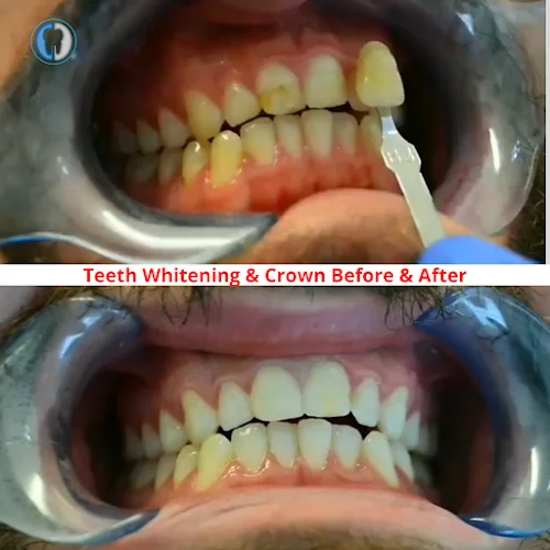 Dr Aiman Sinjab | Emergency Dentist Crewe - Dentist in Crewe