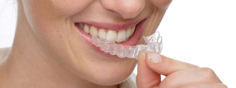 Orthokind - Orthodontist in York