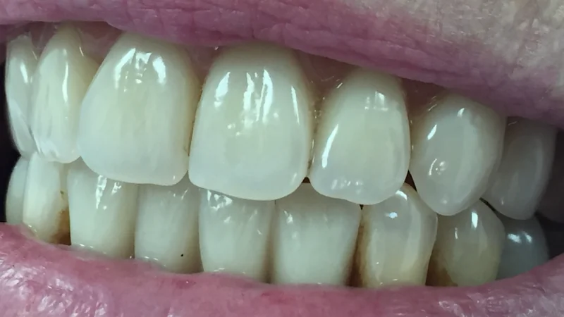 International Smiles - Dental clinic in Burntisland