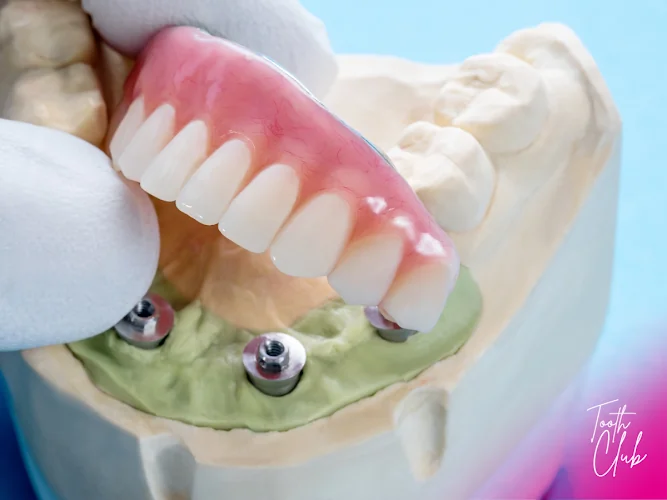 Tooth Club - Birmingham - Cosmetic dentist in Sutton Coldfield