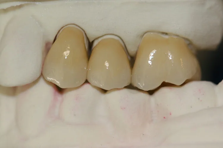 Kurban Dental Laboratory - Dental laboratory in London