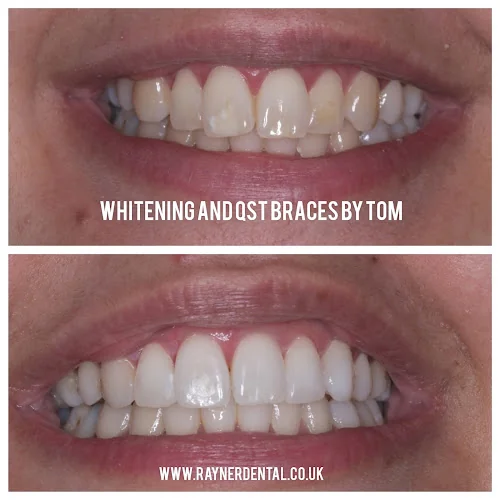 Rayner Dental Practice Wibsey - Dentist in Bradford