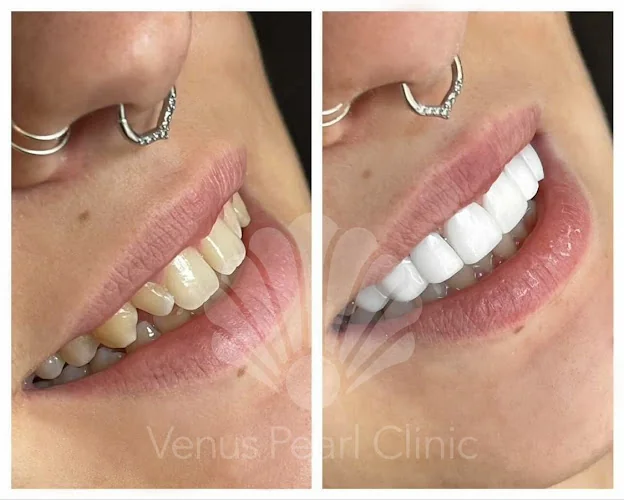 AGS Dental Clinic - Cosmetic dentist in London