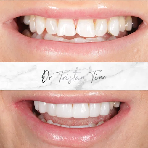 Dr Tristan Tinn - Invisalign | Dentist | Sheffield - Cosmetic dentist in Sheffield