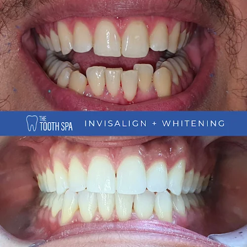 The Tooth Spa - Dentist in Leeds