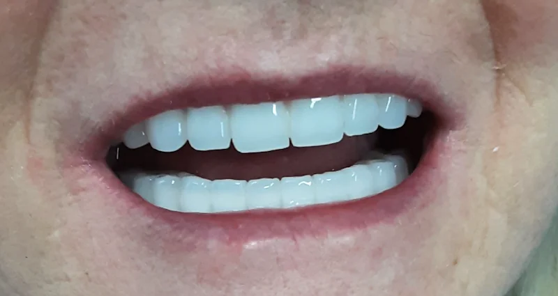 Rodney Street Dental - Dental implants periodontist in Liverpool