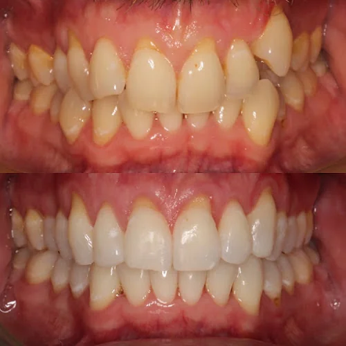 Rathnaa Dentistry & Aesthetics - Cosmetic dentist in Westcliff-on-Sea