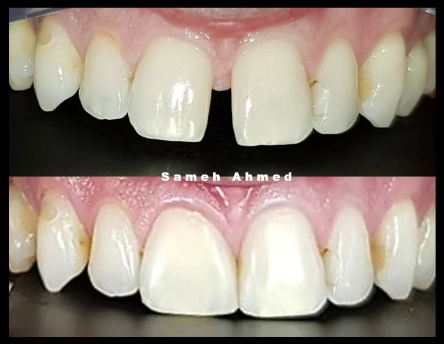 Dr Sam Ahmed Cosmetic and Implant Dentistry - Cosmetic dentist in Stockport