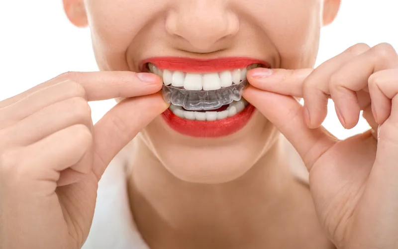 Bandhals dental and verum - Orthodontist in Coventry