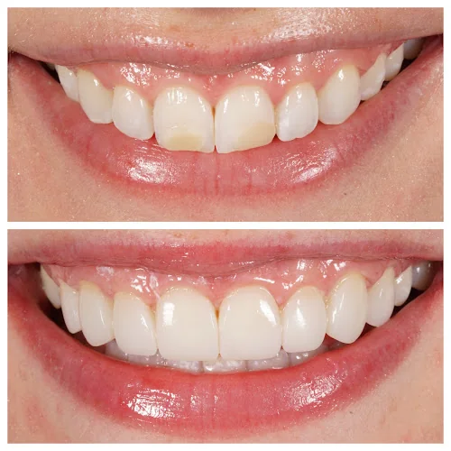 OMG Smiles Cosmetic Dentistry - Cosmetic dentist in St Albans