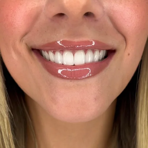 Sync Dental Harley Street - Dentist in London