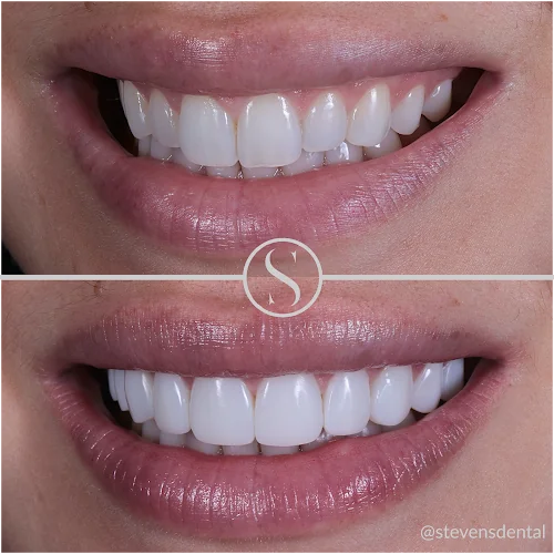 STEVENSDENTAL - Cosmetic dentist in Bolton