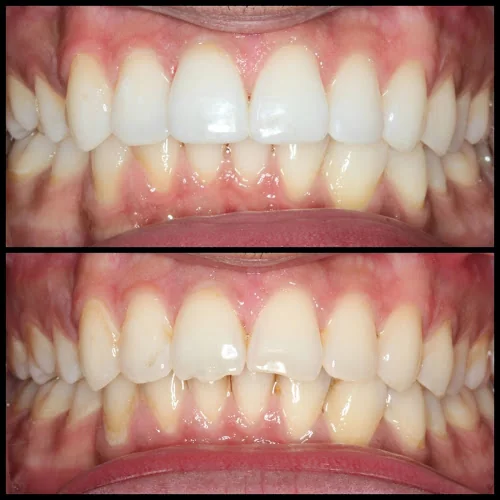 Predent Dental Clinic - Dental clinic in London