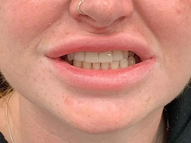 Smile Studio Walk In Centre - Dentist in Nottingham