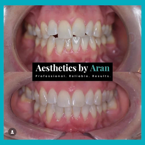 Aesthetics by Aran | Cosmetic Dentist Edinburgh - Cosmetic dentist in Edinburgh