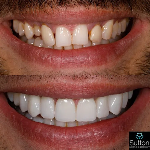 Sutton Aesthetic Dentistry - Dentist in Sutton Coldfield