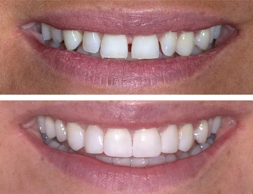 Eternal Smiles Dental Centre - Dentist in Solihull